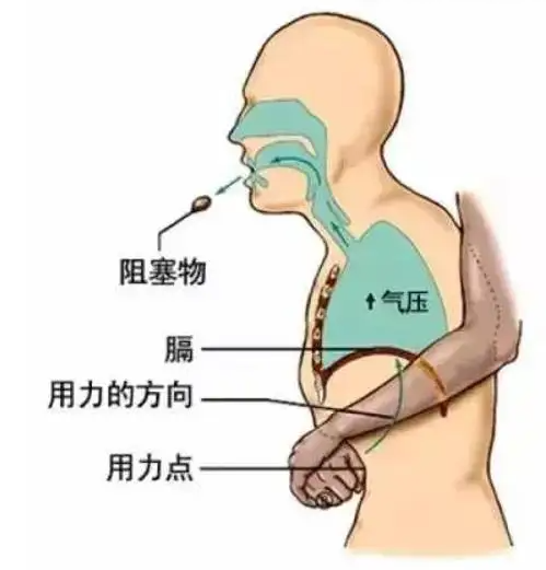 海氏急救法不万能，从源头避免堡贝遇险